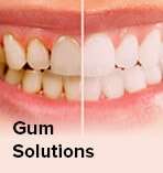 gum solution