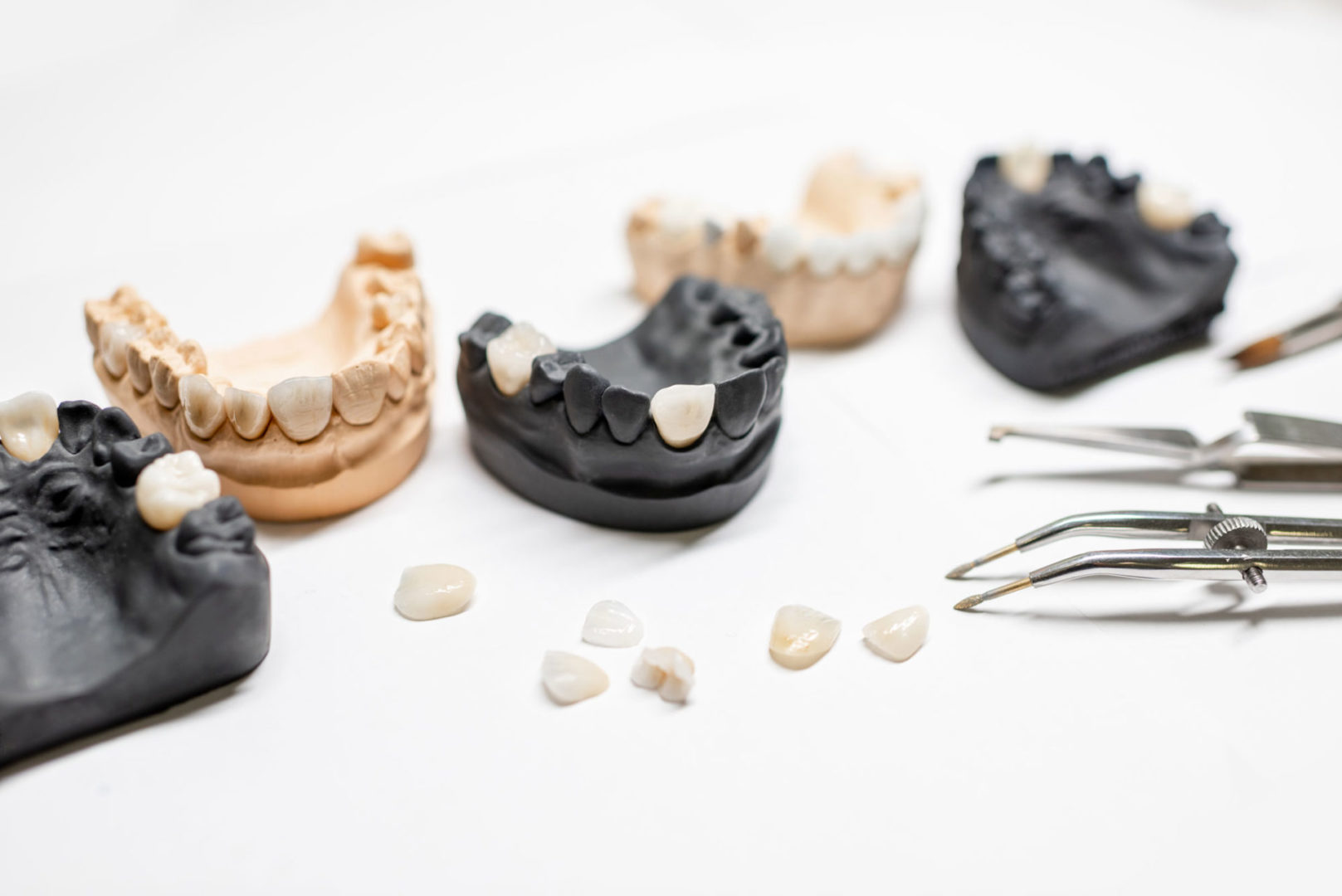 How Many Porcelain Veneers Do I Need? | Smile Concepts